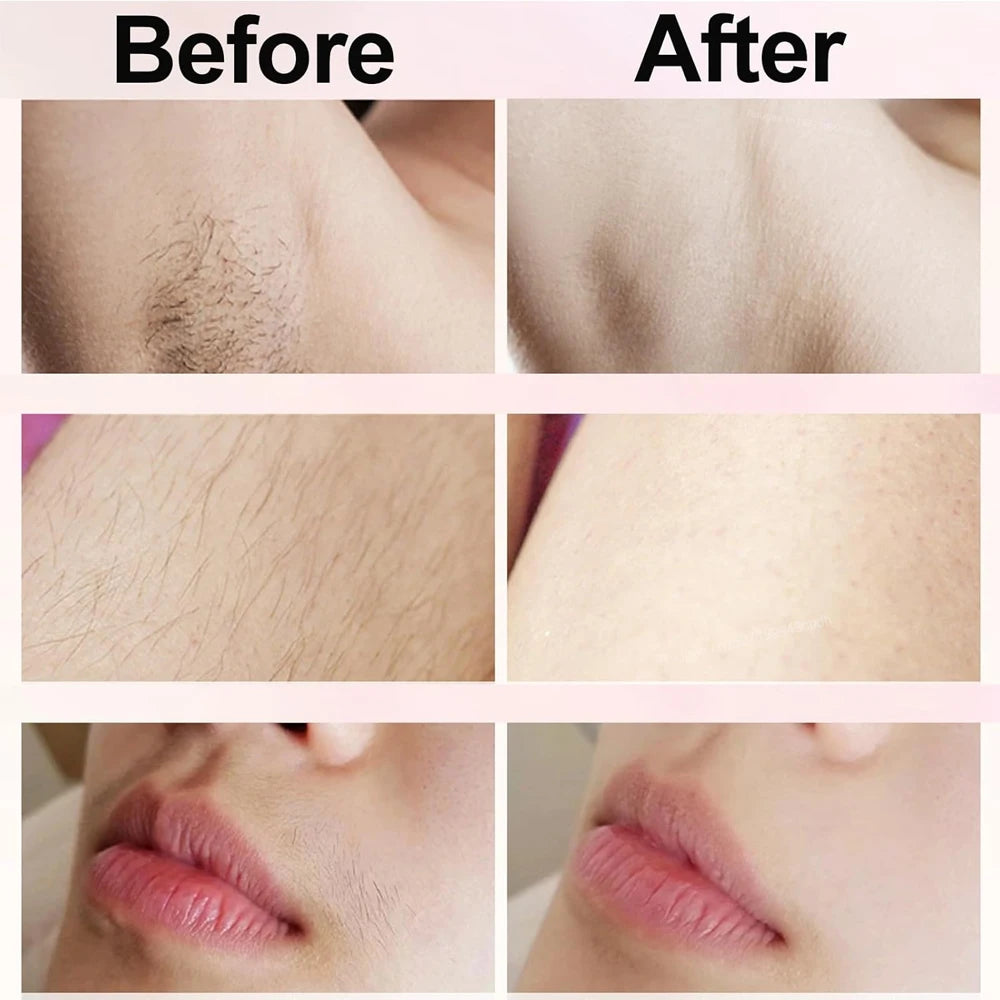 Women's Electric Shaver and Hair Removal System - Facial, Body, and Bikini Trimmer